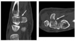 وصف طبي دقيق ومبسط للمريض