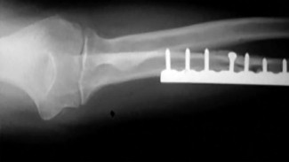 صورة طبية: دليل الأستاذ الدكتور محمد هطيف الشامل لأمراض وإصابات اليد والمعصم في صنعاء