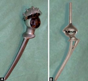 Illustration 11 for Mastering Hip Arthroplasty: Its Evolution and Design Unveiled
