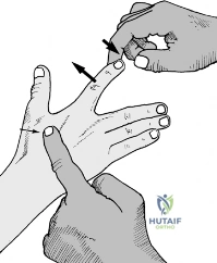 Miscellaneous Nontraumatic Joint Disorders and the Management of Chronic Synovitis