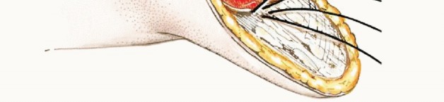 Illustration 17 for Below-Knee Amputation: Maximize Your Below-Knee Recovery & Function