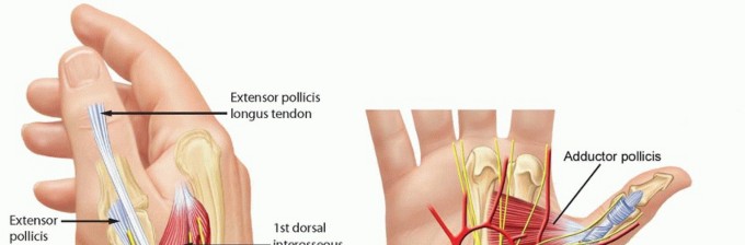 Dislocations and Chronic Volar Instability of the Thumb Metacarpophalangeal Joint