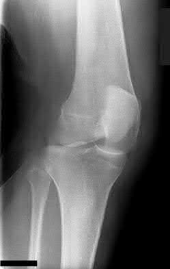 Illustration 67 for OrthoCash: Trauma MCQs & Cases for a yearold woman