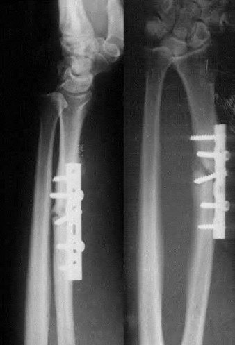 Illustration 97 for OrthoCash: Trauma MCQs & Cases for a yearold woman