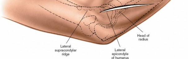 Illustration 89 for Mastering Elbow Approaches: Applied Surgical Anatomy for Precision