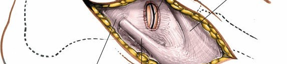 Illustration 191 for Optimized Approaches to the Dorsum of the Foot & Ankle