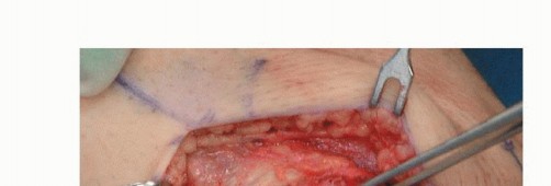 Illustration 16 for Repair & Recover from Collateral Ligament Injuries: Your Guide