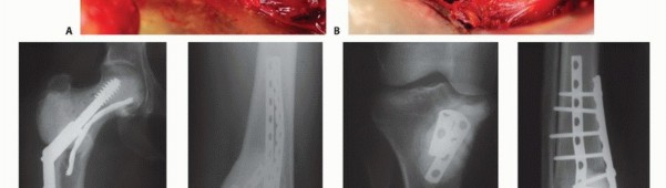 Illustration 11 for Avoid Major Surgery: Bone Tumor Treatment with Liquid Nitrogen Pour