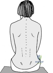 اكتشف أسرار البراغي العظمية: دليلك الشامل لاجتياز FRCS (Tr & Orth)