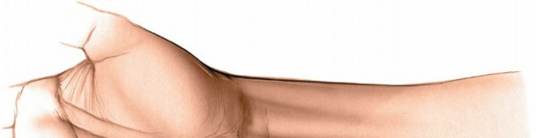 Illustration 43 for Volar Approach: Optimal Exposure for the Volar aspect of the Distal Radius