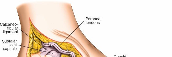 Illustration 131 for Optimized Approaches to the Dorsum of the Foot & Ankle