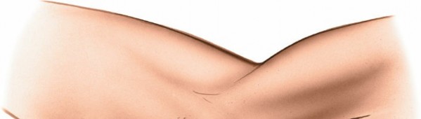 Illustration 26 for Mastering Elbow Approaches: Applied Surgical Anatomy for Precision