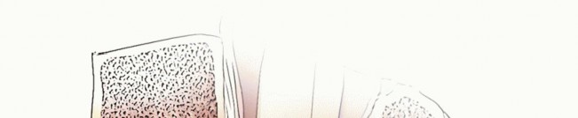 Illustration 22 for Stop Numbness & Instability: Corpectomy and Fusion Guide