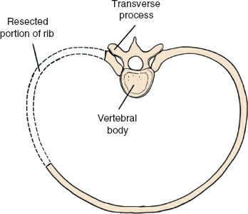 Illustration 320 for Approach to the Lumbar Spine: Mastering Techniques & Anatomy