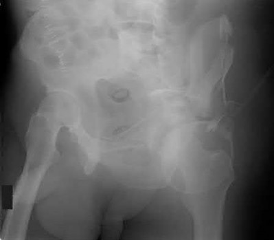 Illustration 23 for OrthoCash: Trauma MCQs & Cases for a yearold woman