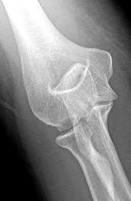 Illustration 82 for OrthoCash: Trauma MCQs & Cases for a yearold woman