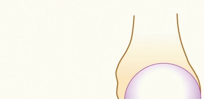 Mastering Latarjet for Bone Loss: Burkhart SS, Lo IK's Key Principles