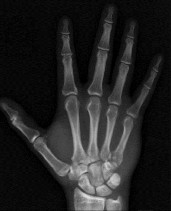 وصف طبي دقيق ومبسط للمريض