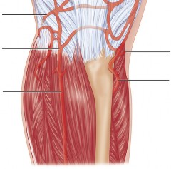 Illustration 7 for The Principles of Revision TKR: Avoid Pitfalls, Ensure Success