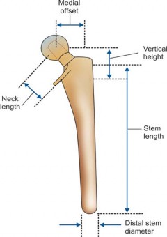 Illustration 31 for Mastering Hip Arthroplasty: Its Evolution and Design Unveiled