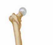 Illustration of knee is tight - Dr. Mohammed Hutaif