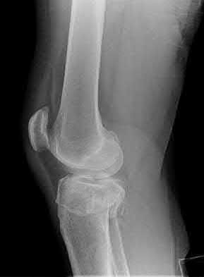 Illustration 184 for OrthoCash: Trauma MCQs & Cases for a yearold woman