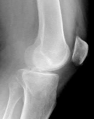 Illustration 25 for OrthoCash: Trauma MCQs & Cases for a yearold woman