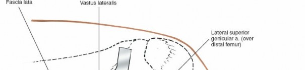 Illustration 225 for Mastering Knee Approaches: Spotlight on Superficial Medial Ligament