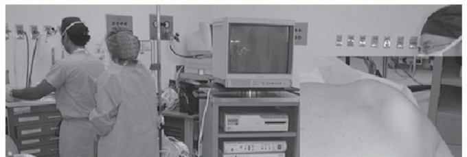 Illustration 11 for Solving Snapping Scapula: Is resection of the superomedial your option?