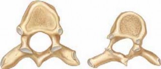 Scoliosis Correction: Optimizing TP & Lamina Screw Placement