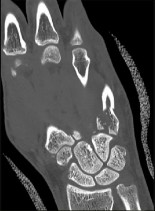 وصف طبي دقيق ومبسط للمريض