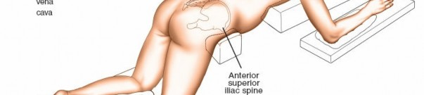 Illustration 3 for Approach to the Lumbar Spine: Mastering Techniques & Anatomy
