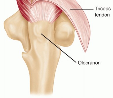 Illustration 30 for Surgical Approaches to Shoulder & Elbow: Pearls and Pitfalls