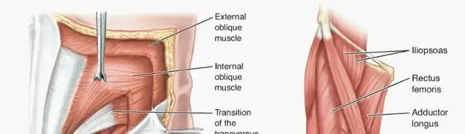 ألم الفخذ الرياضي وإصابات العضلة الضامة: دليل شامل للمرضى مع الأستاذ الدكتور محمد هطيف