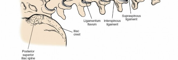Illustration 41 for Approach to the Lumbar Spine: Mastering Techniques & Anatomy