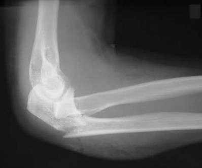 Illustration 30 for OrthoCash: Trauma MCQs & Cases for a yearold woman