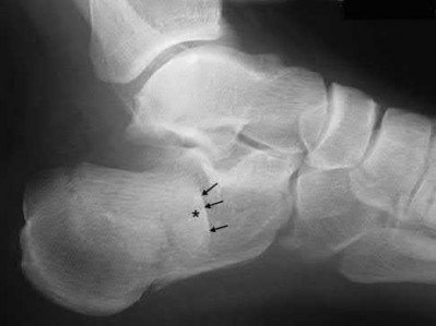 Illustration 18 for OrthoCash: Trauma MCQs & Cases for a yearold woman