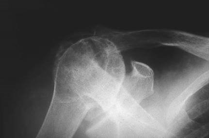 Illustration 24 for Ace FRCS Orthopaedics: Oxford University Press Adult Pathology Viva