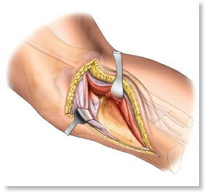 Illustration of surface of the tibia - Dr. Mohammed Hutaif