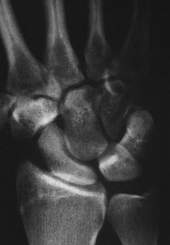 Illustration 11 for Unlock Wrist Diagnosis: Cases Guided by Figure Sunil Thirkannad