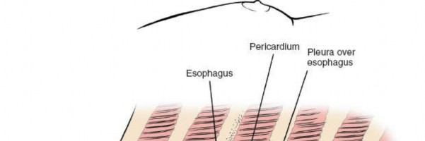 Illustration 337 for Approach to the Lumbar Spine: Mastering Techniques & Anatomy