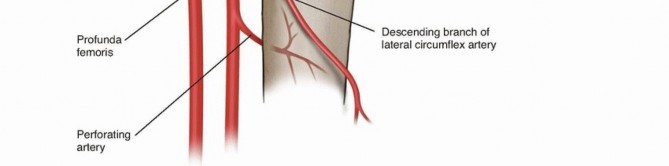 Illustration 4 for Pediatric Femoral Nailing: Targeting the Right aspect of the greater Trochanter