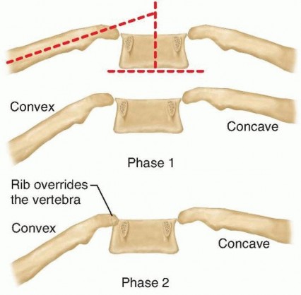 Growing Rod Instrumentation: What You Need to Know for Early Scoliosis