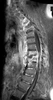 Illustration 11 for OrthoCash: Trauma MCQs & Cases for a yearold woman