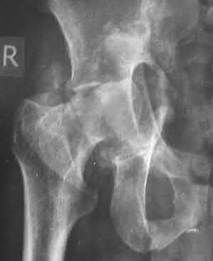 Illustration 60 for OrthoCash: Trauma MCQs & Cases for a yearold woman