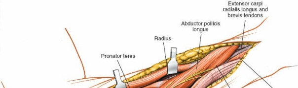 Illustration 11 for Posterior Radius: Expert Tips for Brevis and the Extensor Side