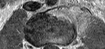 Illustration 20 for OrthoCash: Trauma MCQs & Cases for a yearold woman