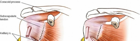 Illustration 29 for Essential Guide: Mastering Every Approach to the Shoulder