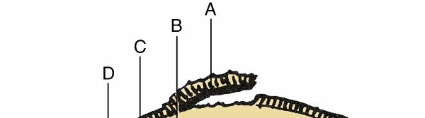 Illustration of cartilage and joint - Dr. Mohammed Hutaif