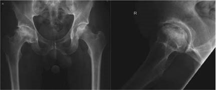 Illustration 14 for Ace FRCS Orthopaedics: Oxford University Press Adult Pathology Viva